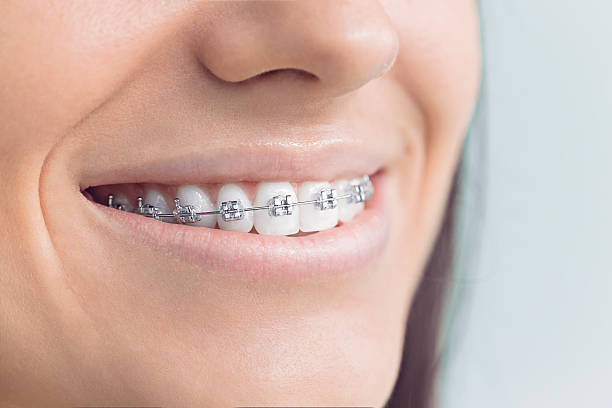 TMJ/TMD Treatment in Weatherford, TX